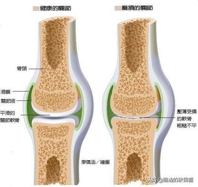 胶原蛋白对骨骼的功效与作用